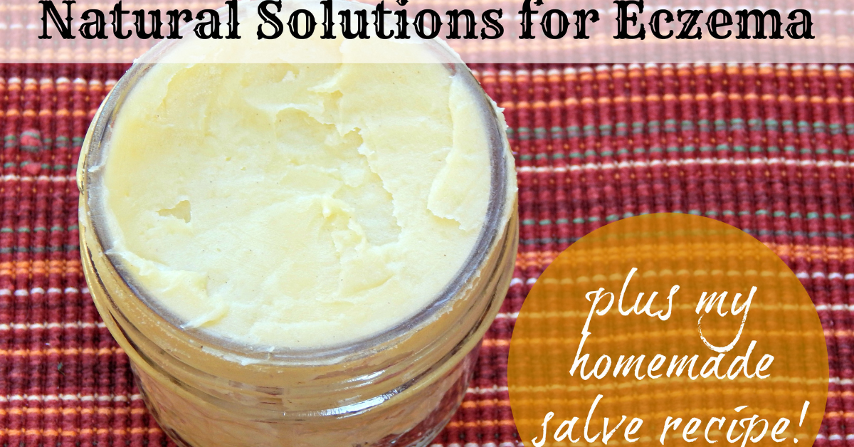 Natural Solutions for Eczema