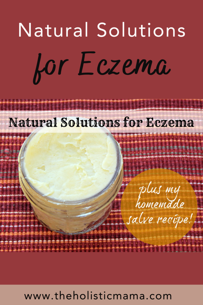 natural solutions for Eczema